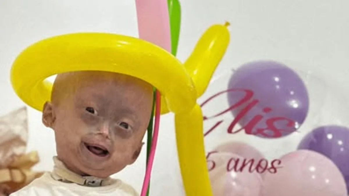 Mãe de Elis, influencer mirim com síndrome rara, lamenta a morte. Veja