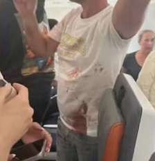 Imagem em rede social mostra passageiros com a camisa suja de sangue; briga entre pilotos fez voo que ia para Israel ser desviado Foto: Reprodução Foto: Reprodução/Rede Social / Estadão