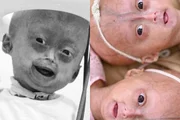 Mãe de Elis, influencer mirim com síndrome rara, lamenta a morte. Veja