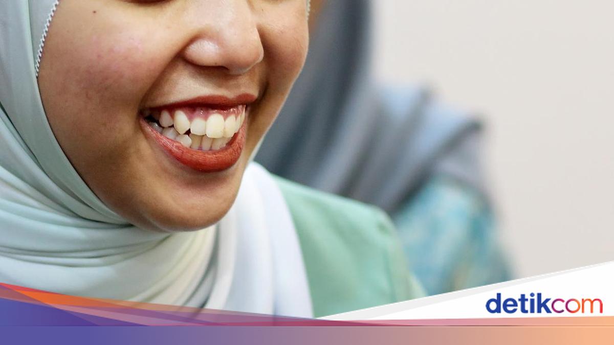 Bikin Senyum Tampak Manis, Gigi Gingsul Normal atau Kelainan? Ini Faktanya
